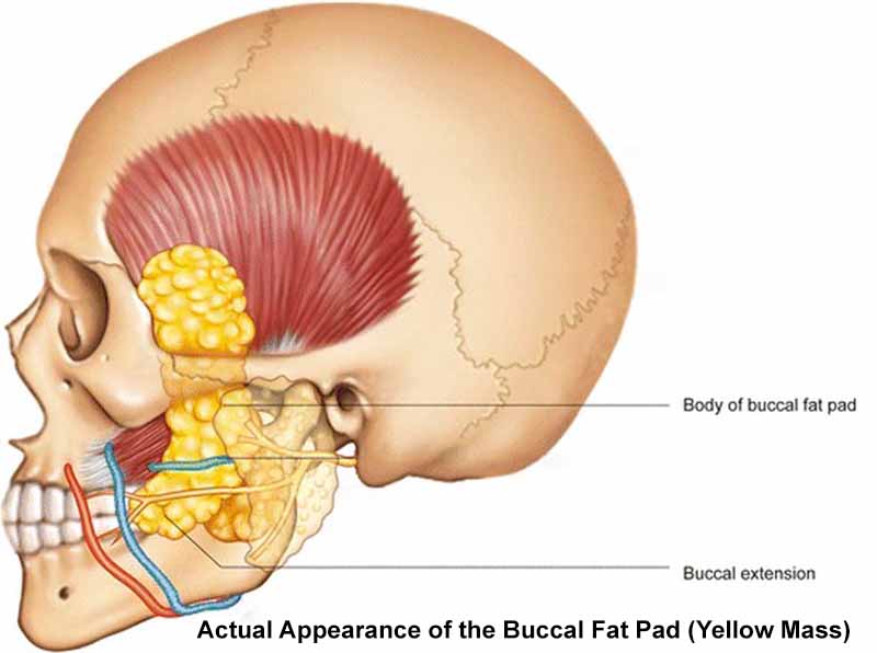 buccal fat pad