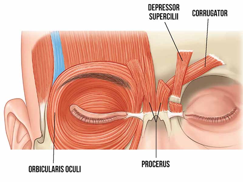 endoscopic brow and forehead lift