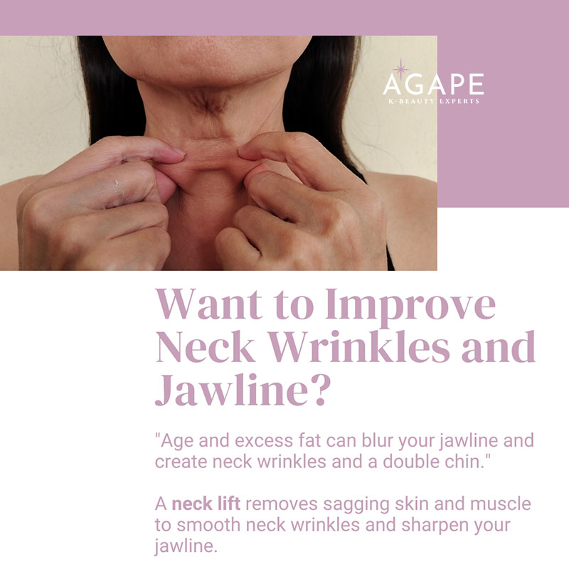 neck-lift-wrinkles